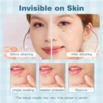 PIMPLE PATCH 0.4g*48PIC - Image 2