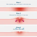PIMPLE PATCH 0.4g*48PIC - Image 4